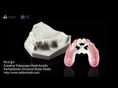 Biocompatibiliteit Tandheelkundige Telescoop Wit Inner Zirconia Buiten Peek Telescoop Tandheelkundige