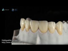 Introduce 0.3mm-0.7mm Feldspathic EMAX Ceramic Veneers Natural Aesthetic Emax Dental Veneers For You