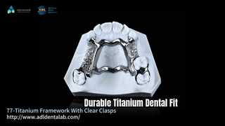 3D Titanium Dental Framework doorzichtige sluitingen