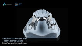 Vitallium Framework Natuurlijke esthetiek Easy Fit