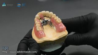 Telescoopkroon Precisie-soldeerkwaliteit