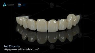 Premium Zirconia Dental Lab Outsourcing-oplossingen