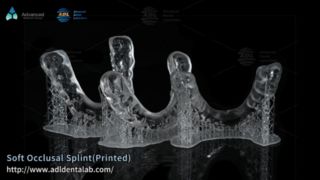 Op maat gemaakte 3D-geprinte nachtbeschermer voor verlichting van tandenknarsen