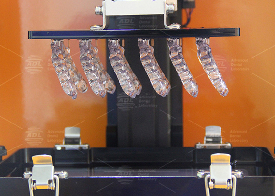 kopen 3D-geprinte zachte occlusal splinten voor bruxisme Comfort tandheelkundige occlusal splinten online vervaardiging