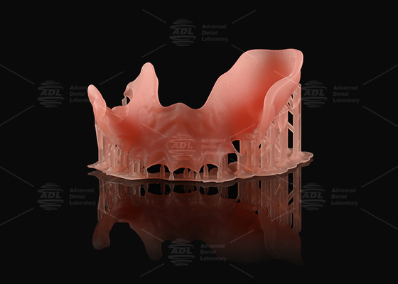 kopen Oranje Roze Acrylische gedeeltelijke tandheelkunde Natuurlijk uitziende 3D-printen Digitale tandheelkunde online vervaardiging