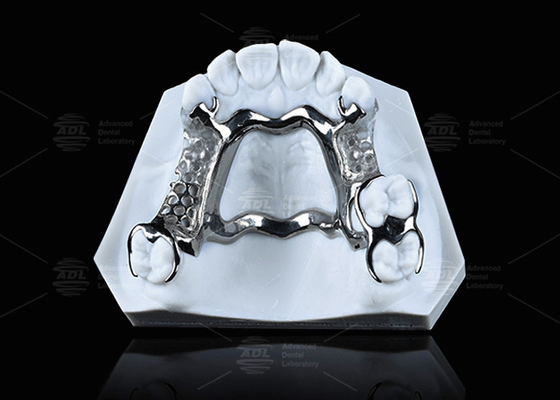 kopen Hoge sterkte 3D gedrukt titanium frame met duidelijke klassen voor duurzame prestaties online vervaardiging