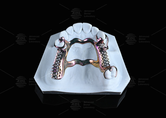 kopen Gevoelige huid Hoge sterkte titanium frame oplossing 3D gedrukt online vervaardiging