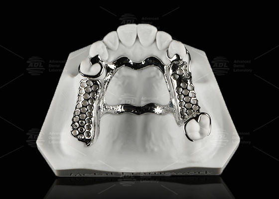 kopen Herstelbaar kobaltchroom tandheelkundig metalen frame gedeeltelijke tandheelkunde online vervaardiging