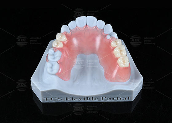 kopen TCS Flexible Partial Stain Resistant BPA Free Partial Protheses voor een natuurlijke uitstraling online vervaardiging