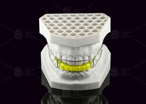 kopen Acryl orthodontische bionator apparaat corrigeert Klasse II Malocclusie online vervaardiging