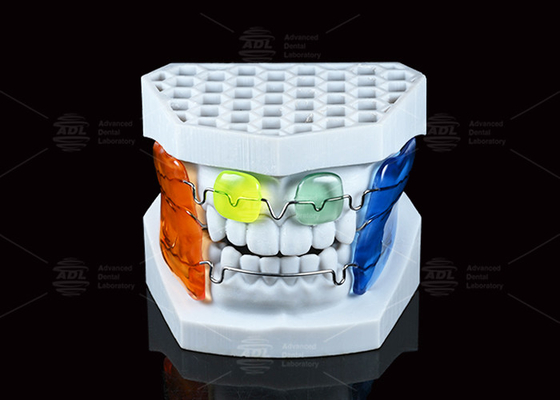 kopen Frankel III Malocclusie Orthodontic Functional Appliance 13-16 uur's nachts online vervaardiging