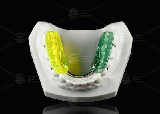kopen Kleurrijke gelb tandheelkundige splinter harde acrylhars occlusal splinter voor's nachts tanden slijpen online vervaardiging