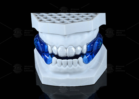 kopen Comfortabele Moses Anti Snorking Guard Soft Stop Snorking Mouthpiece online vervaardiging
