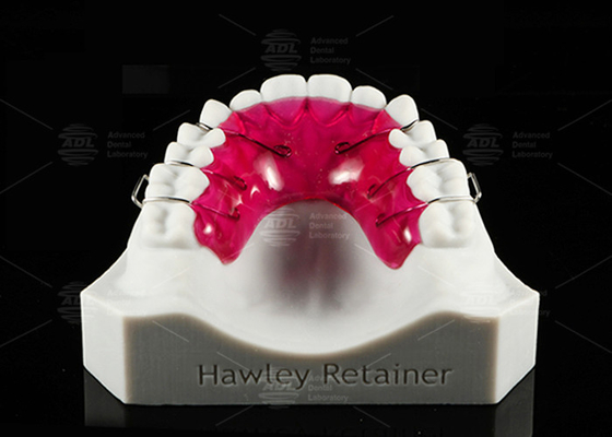kopen Comfortabele roestvrijstalen acryl Hawley retainer Effectieve orthodontische oplossing online vervaardiging