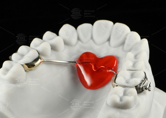 kopen Roestvrij staal orthodontische Nance-apparaat hoefijzerontwerp orthodontische apparaten online vervaardiging