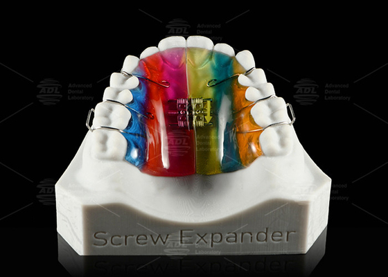kopen Tandvergroting en -distillatie Palate Expander Orthodontic Expander online vervaardiging