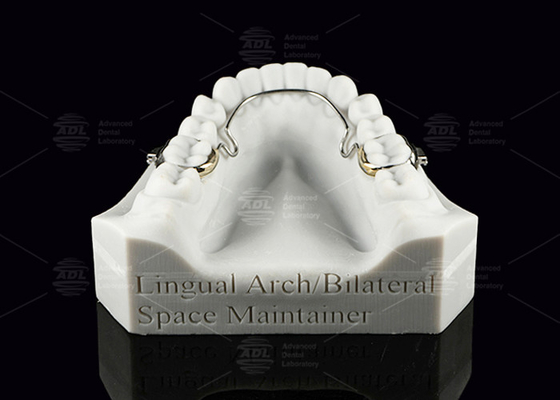kopen Lingual Arch Bilateral Space Maintainer Roestvrij staal Tanden Space Maintainers online vervaardiging