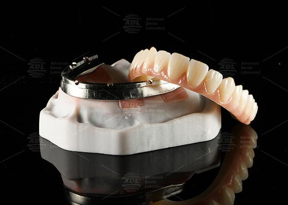 kopen Translucent Full Contour Zirconia Bridge Over Milled Implant Bar online vervaardiging