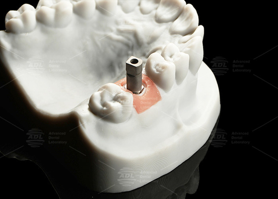 kopen Precision Titanium Digital Implant Scanning Body Sandblasted Surface voor CAD/Cam online vervaardiging