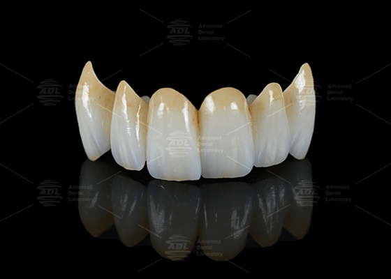kopen Hoge doorschijnendheid Volledige contour Zirconia brug Splinterweerstand Natuurlijke esthetiek online vervaardiging