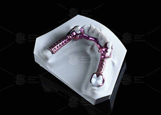 kopen Geanodiseerd 3D titanium frame hoge sterkte en lichtgewicht en verstelbaar online vervaardiging