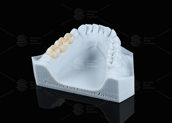 kopen Translucide witte volledige contour Zirconia kroon FCZ Monolithische Zirconia kroon Gemakkelijk frezen online vervaardiging