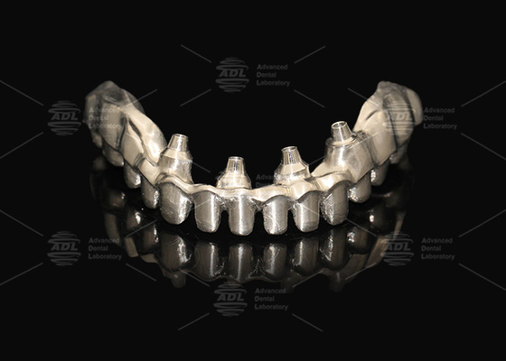 kopen Hybride Roze Porseleinen Implantat Kroon Malong Volle Boog Implantat Brug Onmiddellijke laden online vervaardiging