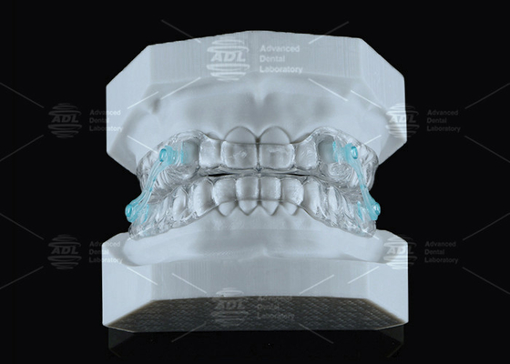 kopen Transparante Erkodent Silensor Anti Snorking Mouthpiece Custom Fit Geluidsreductie online vervaardiging