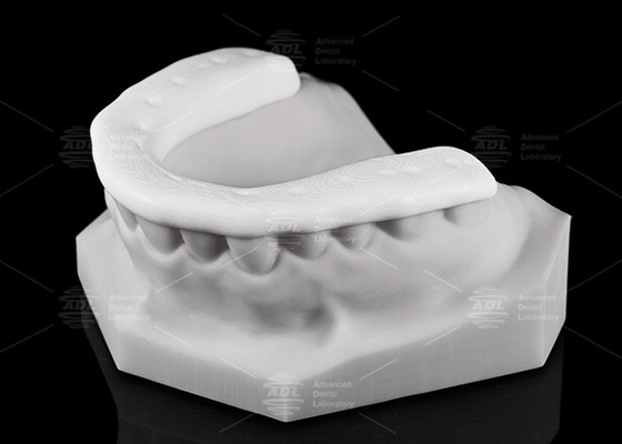 kopen Duurzaamheid en ademend vermogen 3D geprinte nylon oclusal splinter / nachtwacht voor een actieve levensstijl online vervaardiging
