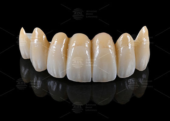 kopen China tandheelkundig laboratorium biedt AIDITE ZIRCONIA BLOCK materialen samen met turnaround tijd in 72 uur voor tandheelkundige productie online vervaardiging