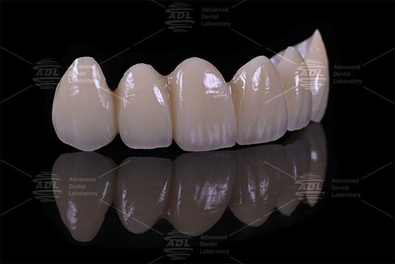 kopen Top 5 China tandheelkundige laboratorium leveranciers Porselein Fused To Zirconia verzekeren van de omlooptijd in 72 uur service voor tandheelkundige kantoren en laboratoria online vervaardiging