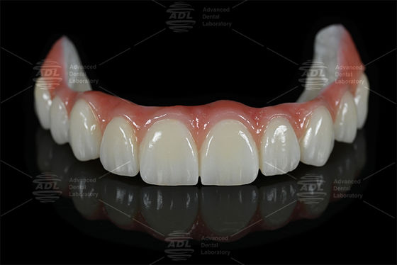 kopen China Dental Lab Titanium En Zirconia Alles op X in 16 tinten inclusief A1 A2 A3 van tandheelkundig lab voor natuurlijke tandheelkundige esthetiek online vervaardiging