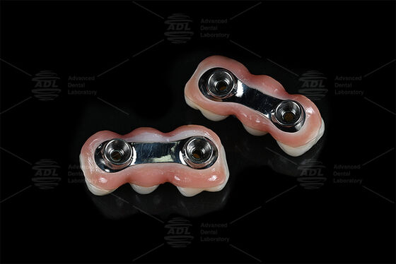 kopen Versterking Implantat Bar CAD CAM Ontworpen voor Precision Fit Compatibel met de meeste tandheelkundige implantat systemen Zorgen voor tandheelkundige hersteloplossingen Chinese tandheelkundige laboratorium online vervaardiging