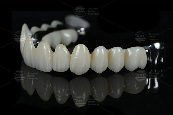 kopen China Dental Lab outsourcing tandheelkundige lab Ti versterkingsstaaf met volledig zirconia bieden concurrerende prijzen met volume kortingen op maat gemaakt voor tandheelkundige professionals die nodig hebben en productie online vervaardiging