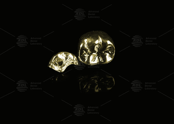 Edel legering Geel goud 60% Volle Metalen Kroon Goud Afwerking Volle Metalen Kroon