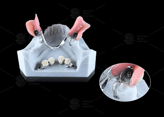 0.1mm Tolerantie CEKA REVAX Aanhangsel Titanium 3mm Verticale vrijheid