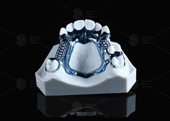 Geanodiseerd 3D gedrukt titanium frame lichtgewicht en geschikt voor gevoelige huid