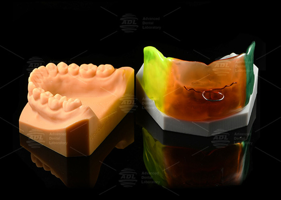 Verstelbaar medisch siliconen vestibulair schild ademend orthodontisch functionele apparaat