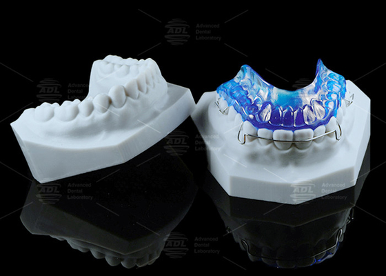 Verstelbare synthetische activeringsapparaat in de orthodontie Functioneel apparaat