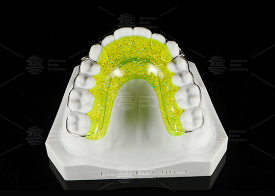 Custom fit BEGGS RETAINER Orthodontic voor tandverstel makkelijk schoon te maken