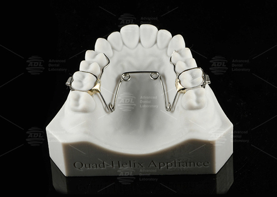 Kinderen en tieners Quad Helix Appliance Orthodontie Roestvrij staal