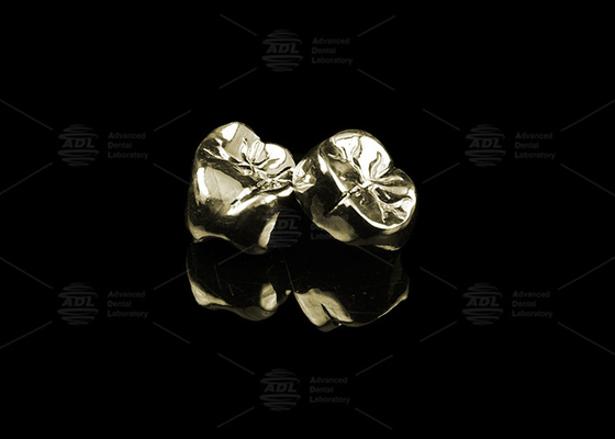 Sleek full cast metalen kroon edelmetaal goud 20% gepolijst full metalen tandkroon