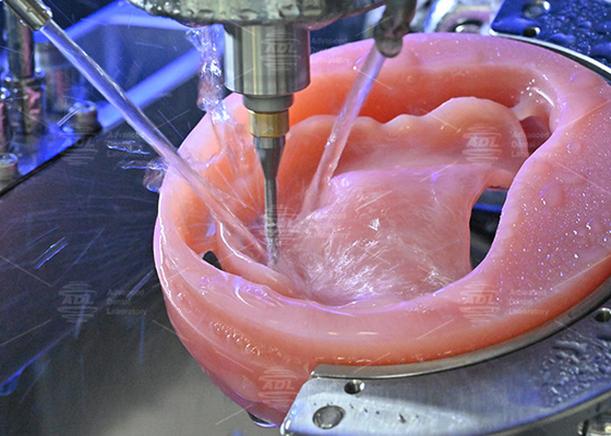 Professionele tandheelkundige praktijk Gefreesde acrylprothese met CAD/CAM-technologie