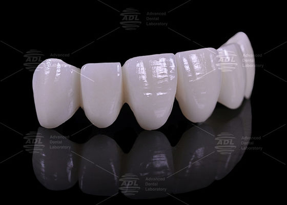 Concurrerende prijzen met volume kortingen tandheelkundig laboratorium met 16 kleuren tandheelkundige prothesen op maat van de medische industrie