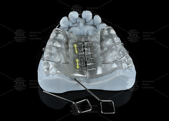 China Tandheelkundig Laboratorium Kleurrijke roestvrijstalen schroefvergrotingsapparaat voor maxilla en mandibulaire uitbreiding