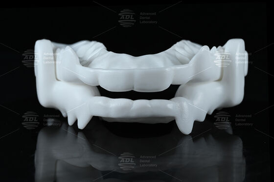Medische kwaliteit Nylon Occlusale Spalk Nachtbitje met Flexibel CAD/CAM Ontwerp voor Bruxisme Bescherming